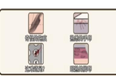 《疯狂爆梗王》消失的女孩攻略