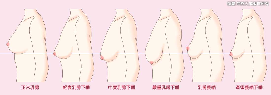 看胸软件_看胸软件_看胸软件